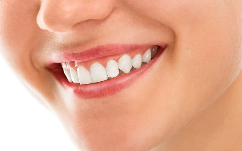 Gum Contouring in Singapore  Perfect Ratio of Gum to Teeth