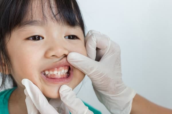 toddler dental check