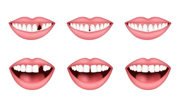 different teeth conditions