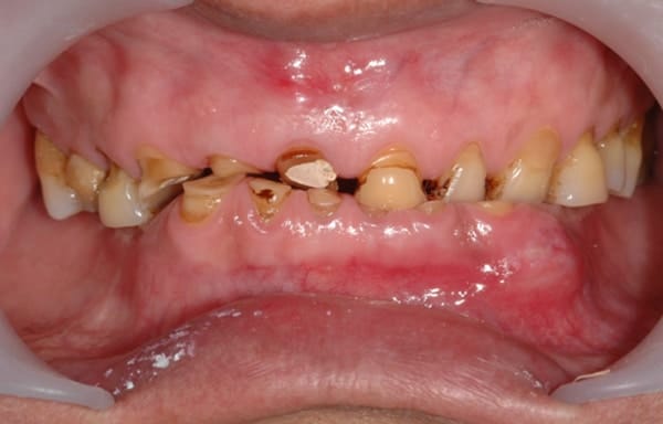prosthodontics conditions