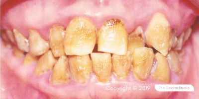 Congenital Defects example