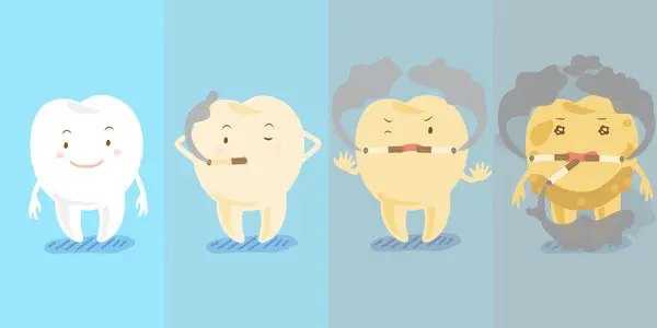 Smoking can damage your teeth