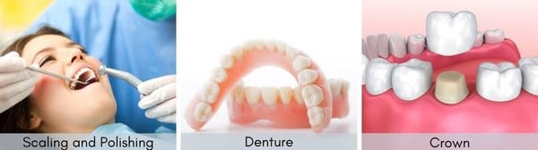 general dental care services scaling polishing denture and crown for merdeka generation package benefits – the dental studio singapore