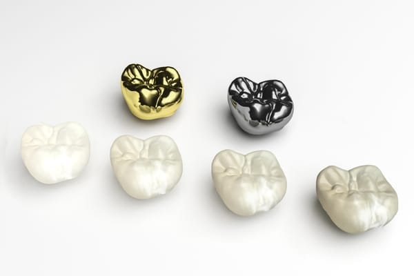 Different Types of Dental Crowns