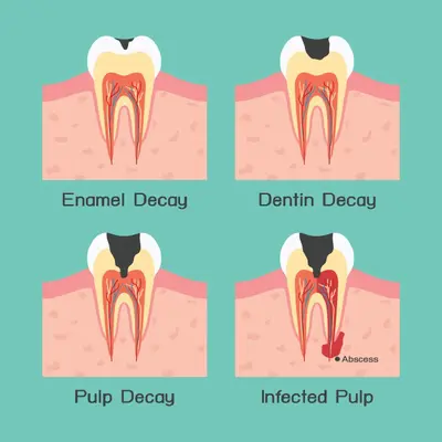 skin and dental caries