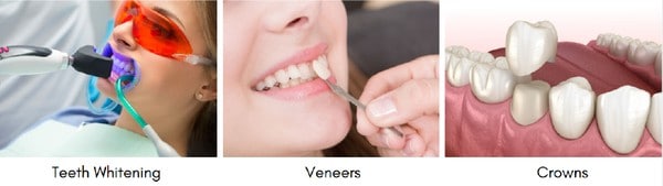 Teeth Whitening, Veneers & Crowns to Remove Tetracycline Stains