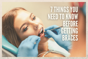 Things You Need to Know Before Getting Braces