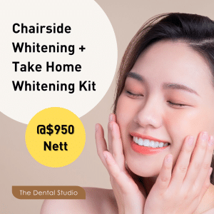 Chairside Whitening + Take Home Whitening @ $950 Nett