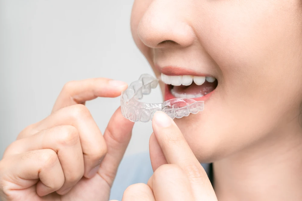 Mouthguards
