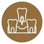 dental implant at dental studio