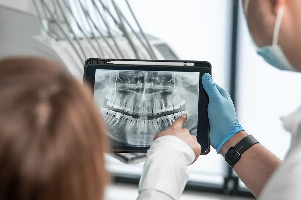Dental X-ray Dental X-ray